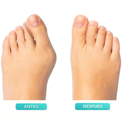 🎁 Father's Day Deal 👣Adjustable Bunion Corrector Toe Alignment Brace–  Breathable, Washable