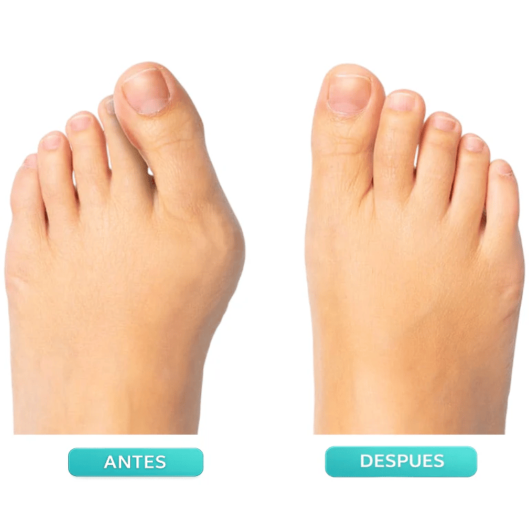 👣 Toe Separator & Support Strap – Adjustable Knob, Breathable, Washable