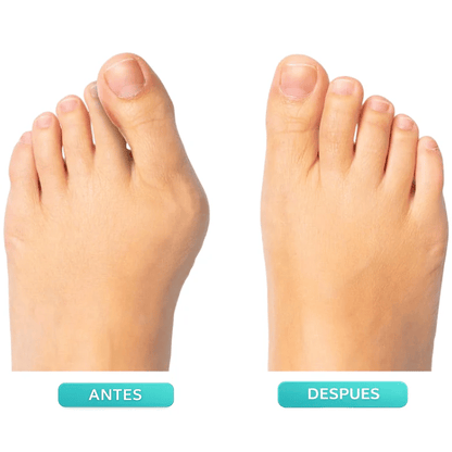 👣 Toe Separator & Support Strap – Adjustable Knob, Breathable, Washable