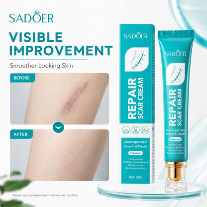 Deep Repair Scar Cream