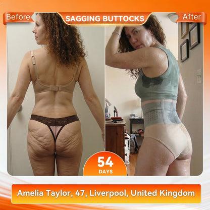 Official Brand Store|2026 Moringa & Berberine 4-in-1 Micro-Particle Shaping & Fat Burning Shorts