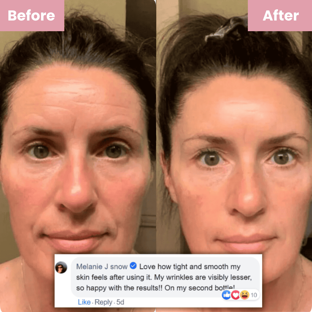 🔥Hot Sale 50% OFF🔥 Glass Skin Collagen Mask