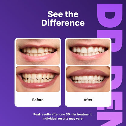 HOT SALE 60% OFF🔥Purple Teeth  Whitening Strips – Fast Results, Zero Sensitivity