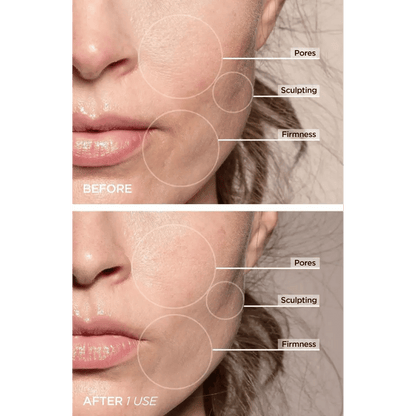 Last Day Promotion 60% OFF🔥 Facial & Neck Skin Lifting Massager