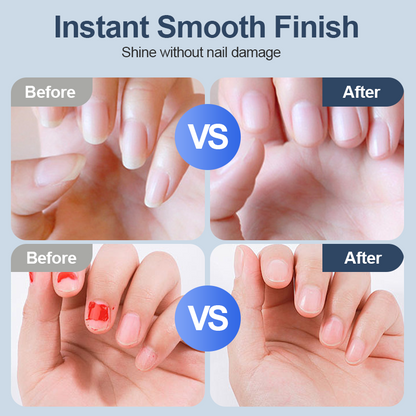 🔥Hot sale 49% off 🔥 Universal automatic nail file for adults and children